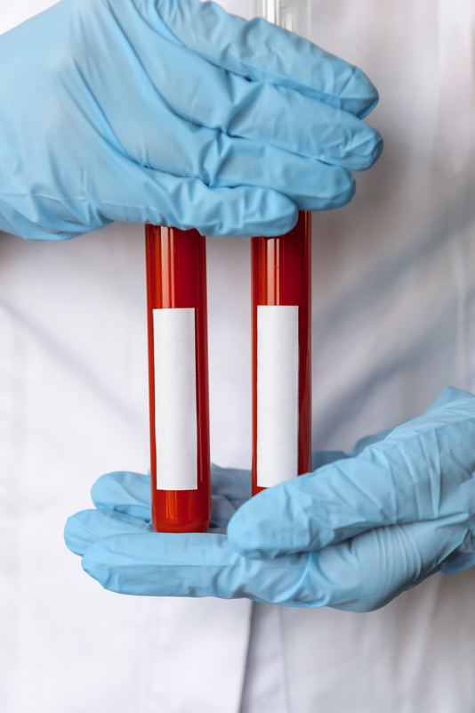 handling blood specimens